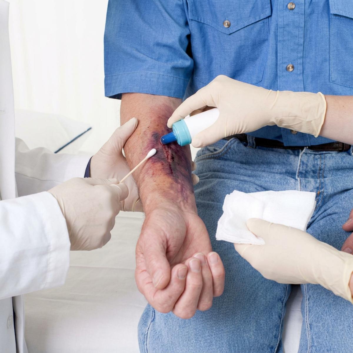 Wound care in your Home