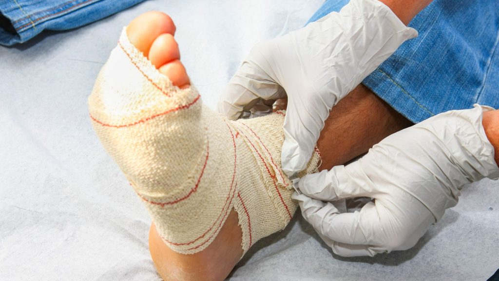 How Long Does a Diabetic Foot Ulcer Take to Heal? 2 diabetic foot ulcer recovery