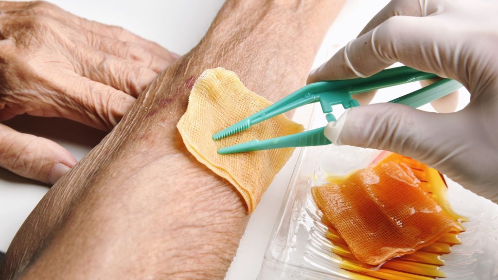 How to Care for an Infected Wound at Home: Signs, Treatment, and When to Call a Professional 2 wound infection prevention