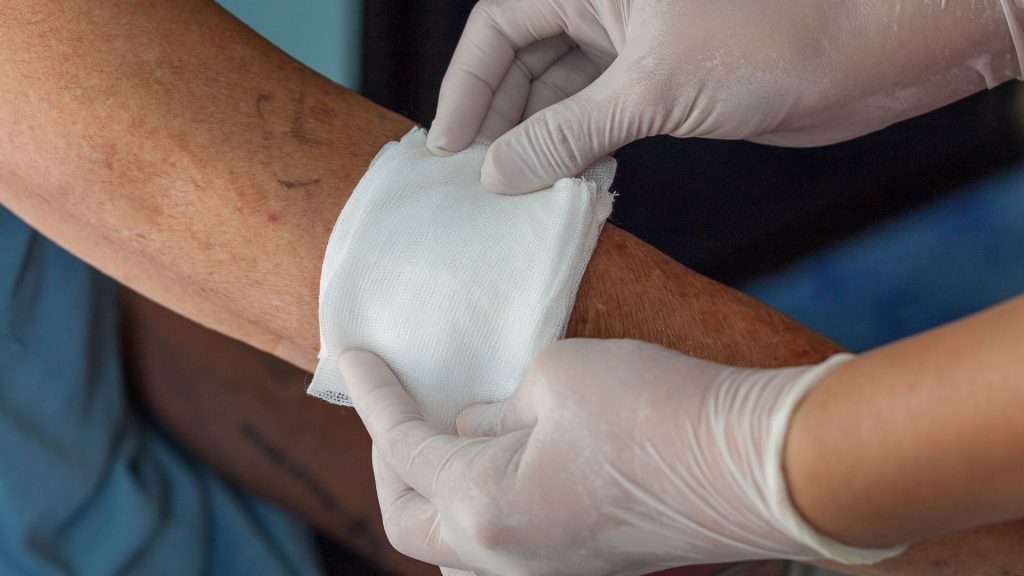 How to Care for an Infected Wound at Home: Signs, Treatment, and When to Call a Professional 1 signs of infected wound