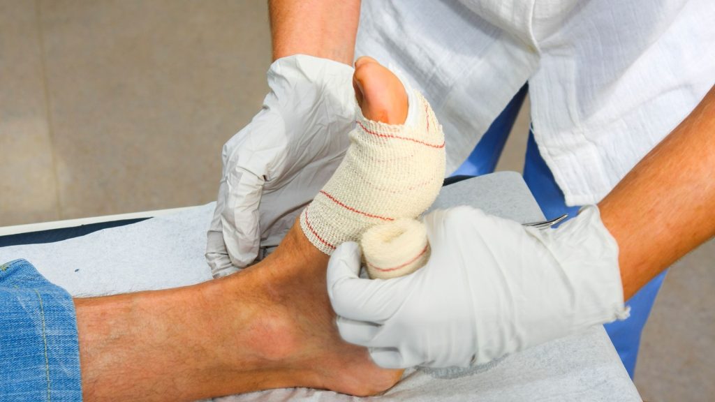 infected puncture wound signs