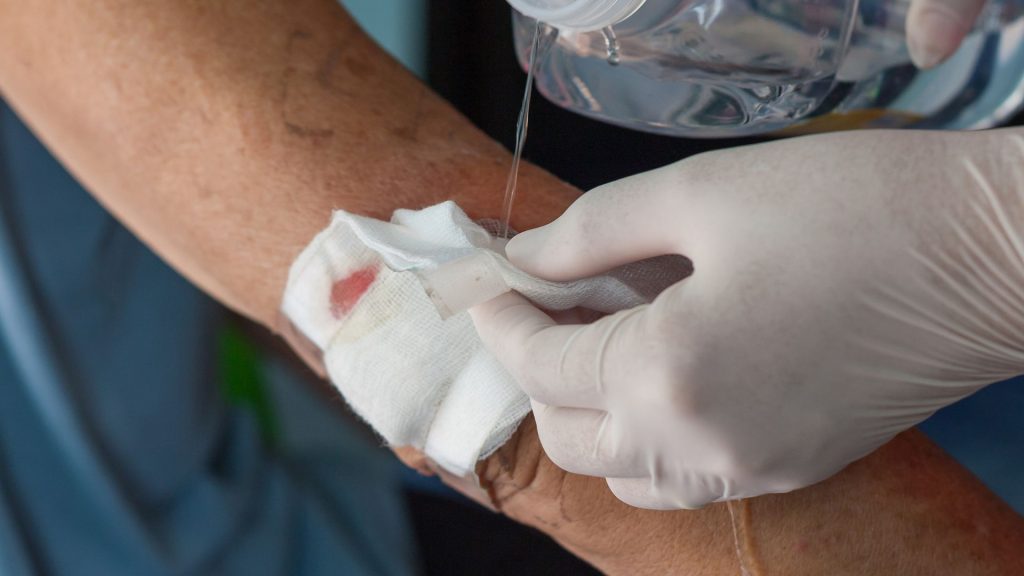 How to Speed Up Wound Healing: Evidence-Based Tips That Work 1 wound healing stages