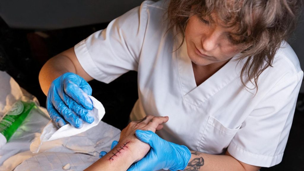 How Long Does a Stitched Wound Take to Heal? 2 stitches recovery timeline